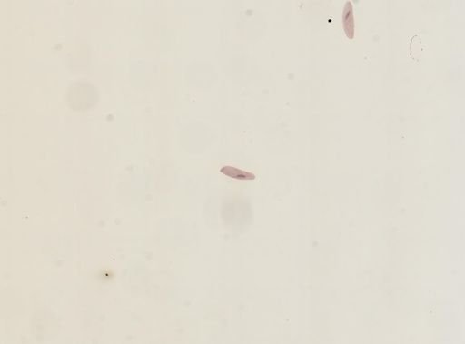 Paramecium caudatum