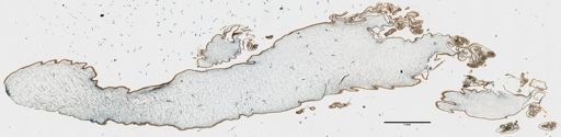 Cassiopea xamachana