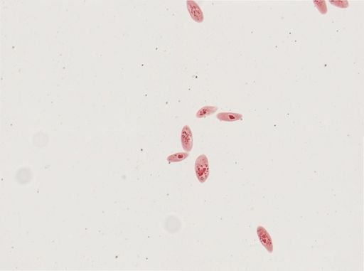 Paramecium calkinsi