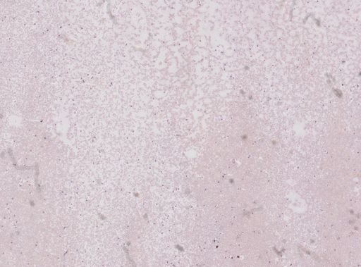 Trypanosoma brucei rhodesiense