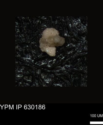 undet. Foraminiferida