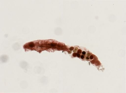 Dactylobiotus