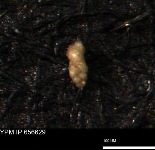 Verneuilina canadensis