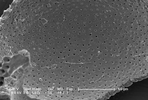 Globigerinella siphonifera