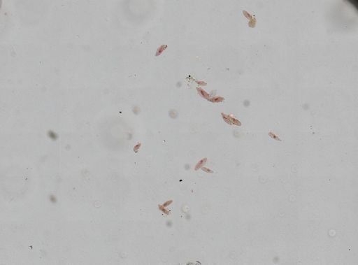 Eucestoda