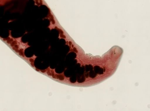 Haematoloechus medioplexus
