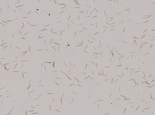 Haliclona oculata