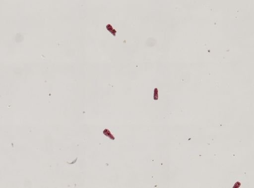 Fasciola hepatica