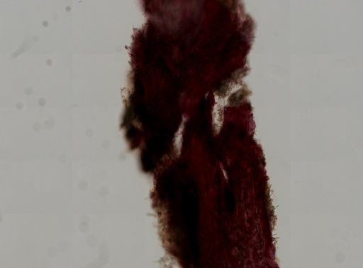 Myrmekioderma