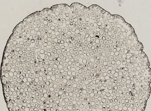 Ascaris megalocephala