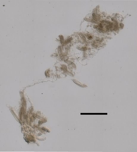 Chelophyes appendiculata