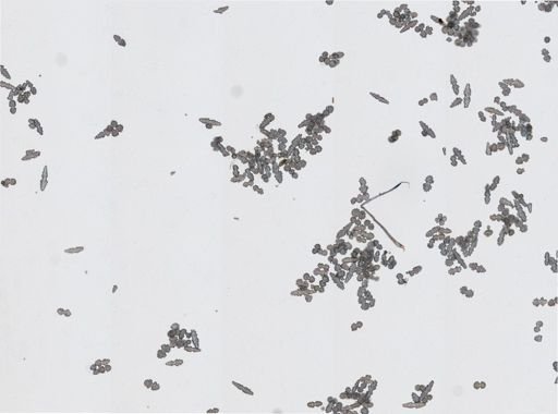 Ellisella sp.