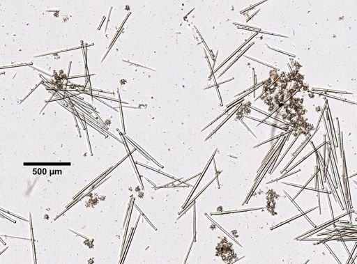 Diplastrella megastellata