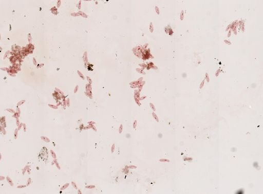 Paramecium
