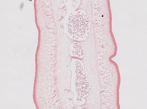Taenia saginata