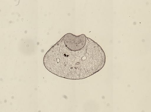Dicrocoelium dendriticum