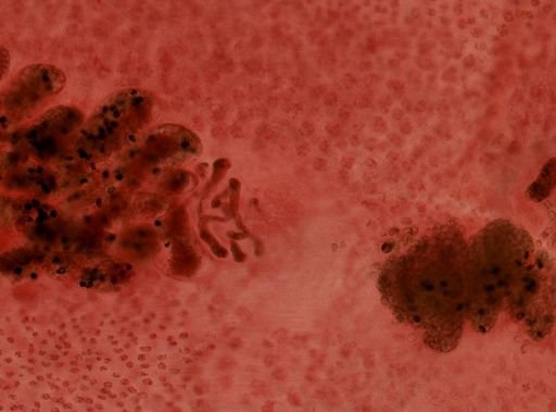 Diphyllobothrium latum