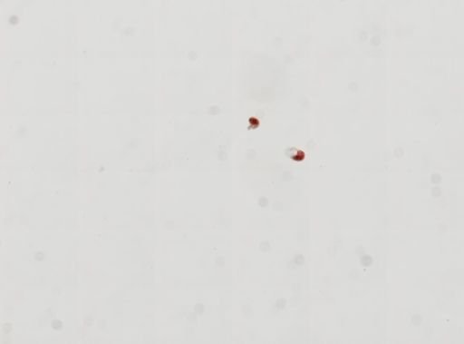 Trematoda