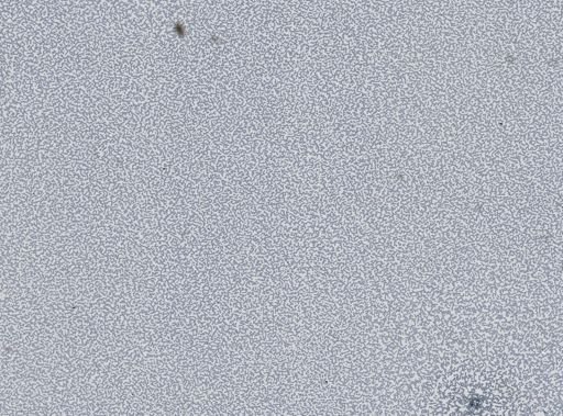 Plasmodium vivax