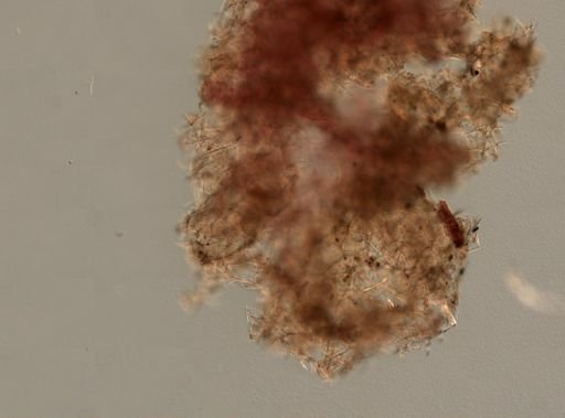 Haliclona sp.