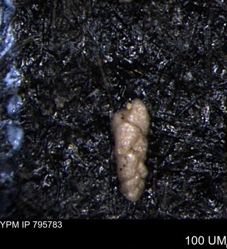 Verneuilina canadensis