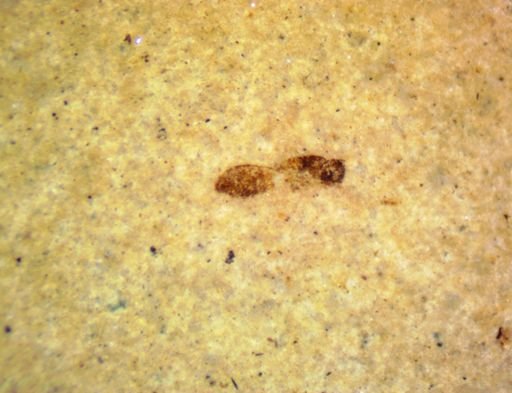 undet. Hexapoda