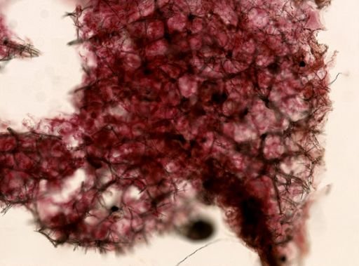 Isodictya deichmannae