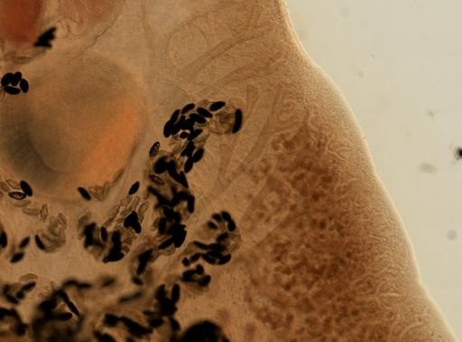 Fasciola hepatica