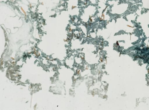 Dactylospongia elegans