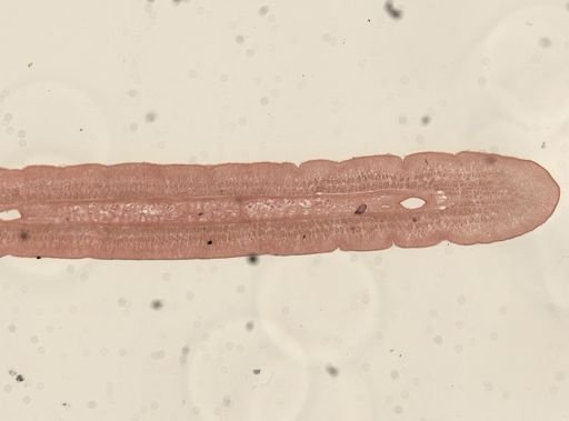 Taenia taeniaeformis