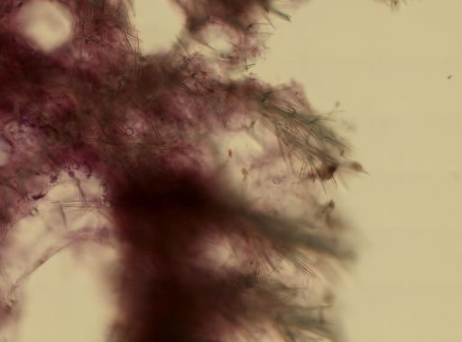 Axinella
