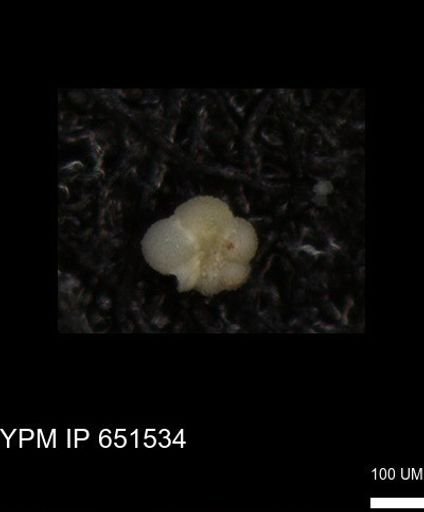 undet. Rugoglobigerinidae