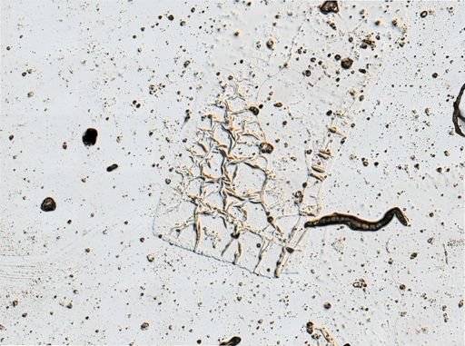 Watersipora nigra
