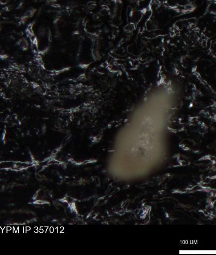 undet. Foraminiferida