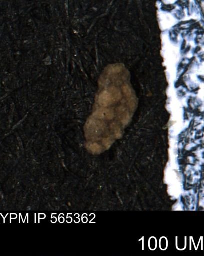 Verneuilina canadensis
