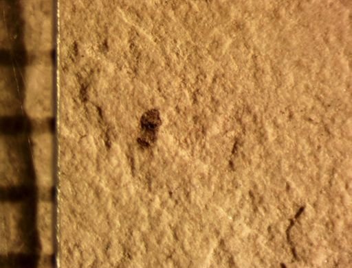 Hemiptera?