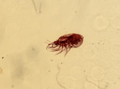 Centropages typicus