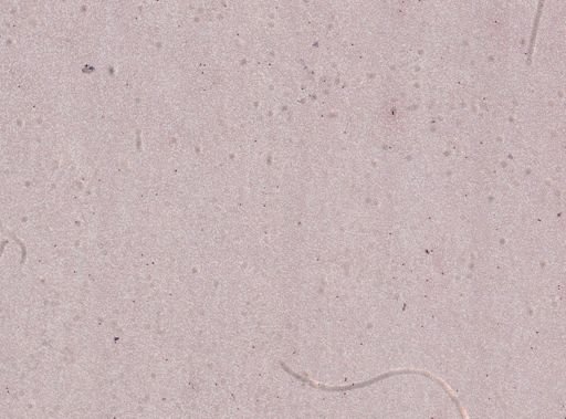 Plasmodium falciparum