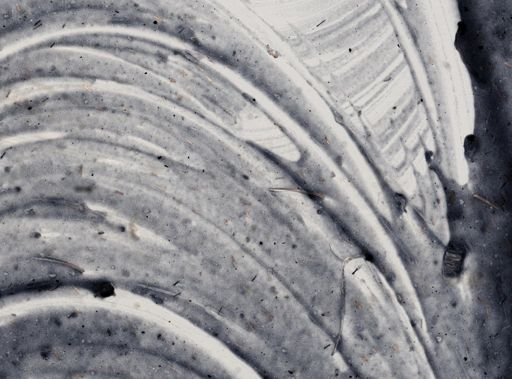 Entamoeba histolytica