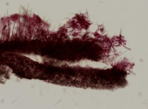 Tedania suctoria