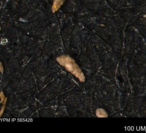 Verneuilina canadensis