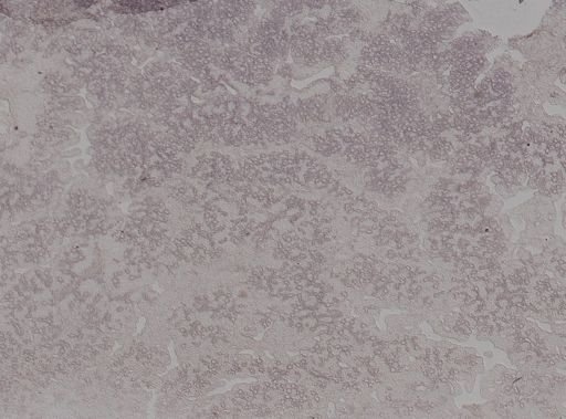 Plakortis sp.
