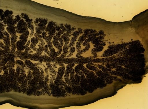 Taenia saginata