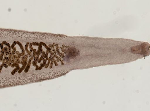 Clonorchis sinensis