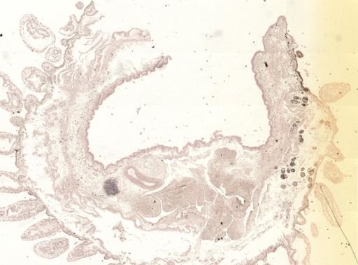 Thysanozoon brocchii