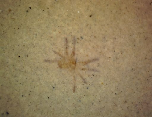 undet. Araneae