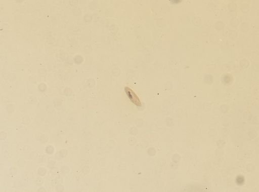 Paramecium multimicronucleatum