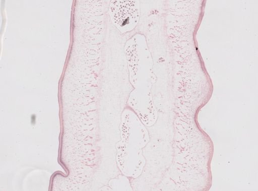 Taenia saginata