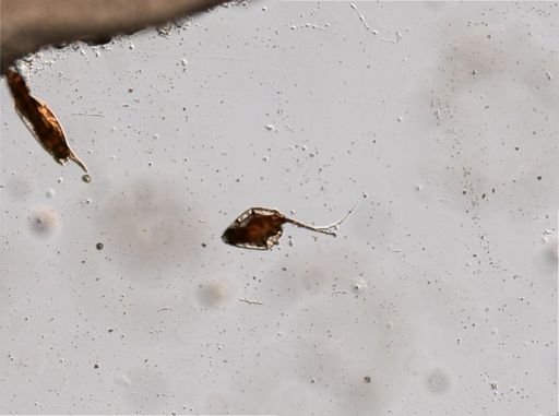 Trichocerca