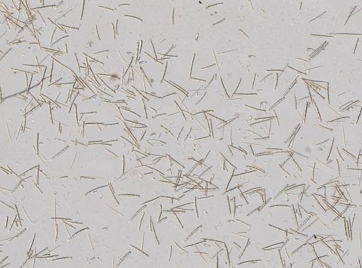 Myxilla parasitica